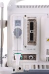 DIAGNOSTIC ULTRASOUND SONOSCAPE S2 Scanner