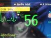 PHILIPS Intellivue X2 M3002A ; Companion Module;Masimo SpO2~Patient Monitor