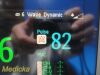 PHILIPS 2016  Intellivue M3002A X2; 865039 Companion Module~  Patient Monitor