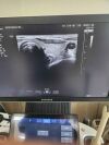 SAMSUNG W10 Ultrasound - OB / GYN - Vascular