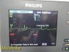 PHILIPS Intellivue MP2 Ref M80102 Patient Monitor