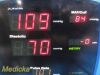 DINAMAP 2010 GE  Carescape V100 , W/ Battery, PSU & Leads ~Patient Monitor