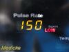 GE 2007  Procare 400 Series ,W/ NEW BATTERY, 2X Leads & PSU ~Patient Monitor
