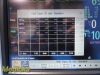 PHILIPS 2012  MP5 M8105A (865024) , (NBP, SPO2, ECG, IBP, T) W/ Leads~ Monitor