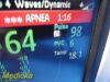 PHILIPS 2012  MP5 M8105A (865024) , (NBP, SPO2, ECG, IBP, T) W/ Leads~ Monitor