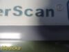 VERATHON Diagnostic Ultrasound 0570-0090 BladderScan BVI 3000 Console W/ Battery
