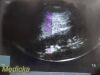 SONOSITE 2009  P21x/5-1Mhz Sector Array Ultrasound Transducer