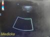 SONOSITE 2009  P21x/5-1Mhz Sector Array Ultrasound Transducer