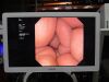 OLYMPUS GIF-XP190N Gastroscope
