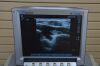 SONOSITE Fujifilm  M-Turbo Ultrasound System P08189-34 w/ P21x5-1 and L25x13-6 MHz Transducer - 174533