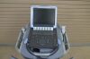 SONOSITE Fujifilm  M-Turbo Ultrasound System P08189-34 w/ P21x5-1 and L25x13-6 MHz Transducer - 174533