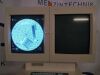 ZIEHM Exposcop 8000 C-Arm