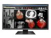 EIZO MX317W Monitor