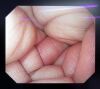 OLYMPUS GIF-Q240 Endoscope
