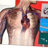 MERIT MEDICAL REF SUPERHERO, Venous Outflow and Adapter Component Kit, EXP 2024-05