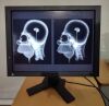 EIZO RadiForce GS310 X-Ray Monitor