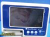 VERATHON 0231-0003 GVL Glidescope Video Monitor