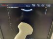 MEDISON Accuvix XG Ultrasound - Shared Service