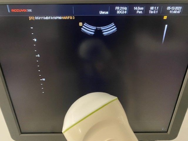 MEDISON Accuvix XG Ultrasound - Shared Service