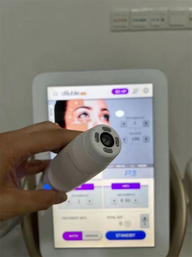 ULTHERA Hironic MFU&RF WRINKLES REMOVAL ANTI-AGING MACHINE FOR SALE Laser - Radio Frequency (RF)