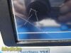 PHILIPS 2016  Vitals Signs VS4 Ref 863283 ,(SPO2;NBP;TEMP) W/ Leads ~ Monitor