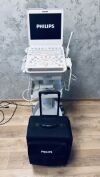 PHILIPS CX50 Cart C.0 in excellent condition Ultrasound - OB / GYN - Vascular