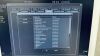 PHILIPS CX50 Cart C.0 in excellent condition Ultrasound - OB / GYN - Vascular