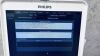 PHILIPS CX50 Cart C.0 in excellent condition Ultrasound - OB / GYN - Vascular