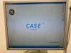 GE Case Exercise Testing System Stress Test