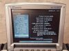 SONOSITE M Turbo 2015 Mobile Ultrasound