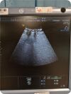 GE Voluson E6  Ultrasound System