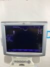 GE Logiq P5 