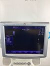 GE Logiq P5 