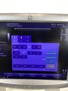 GE Logiq P5 