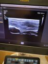 PHILIPS Affiniti 70G Shared Service Ultrasound - Shared Service