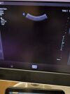 PHILIPS Affiniti 70G Shared Service Ultrasound - Shared Service