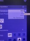 ACUSON SIEMENS  PRIME SC2000 W/ 3 Probes! P/N: 10433816 MFD: 2016 Ultrasound - Shared Service