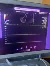 ACUSON SIEMENS  PRIME SC2000 W/ 3 Probes! P/N: 10433816 MFD: 2016 Ultrasound - Shared Service