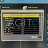 TOSHIBA Aquilion One 320 CT Scanner