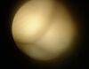 OLYMPUS WA2T430A Cystoscope