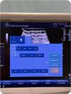 GE HEALTHCARE LOGIQ P5  Ultrasound machine