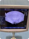 GE HEALTHCARE LOGIQ P5  Ultrasound machine