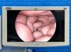 KARL STORZ Spies Tower TC200, TC300, TH100, Thermoflator Laparoscope