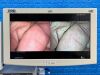 KARL STORZ Spies Tower TC200, TC300, TH100, Thermoflator Laparoscope