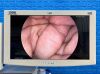 KARL STORZ Spies Tower TC200, TC300, TH100, Thermoflator Laparoscope