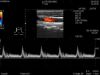 HITACHI Probe L64