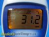 W. Allyn Hill Rom SureTemp Plus 692 Thermometer