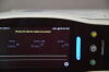 MASIMO Radical 7 Rainbow MasimoSET Pulse Oximeter w/ RDS-1 Docking Station - 175632 Oximeter - Pulse