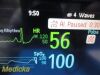 PHILIPS 2018  Intellivue MP5 Ref M8015A Patient Monitor