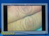 STRYKER Endoscopy Vision Elect 26" HDTV Monitor